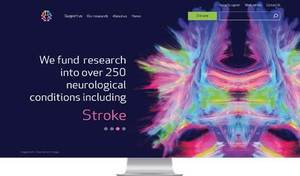 Image: Brain Research Trust Image: Brain Research Trust